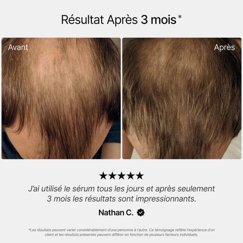 Sogains® - Huile de croissance pour cheveux