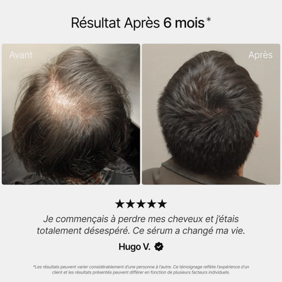 Sogains® - Huile de croissance pour cheveux