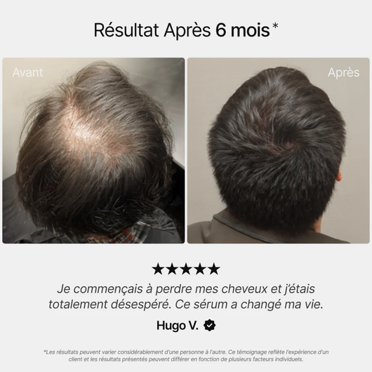 Sogains® - Huile de croissance pour cheveux