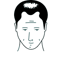 Phase de réinitialisation