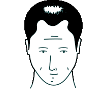 Phase de stabilisation